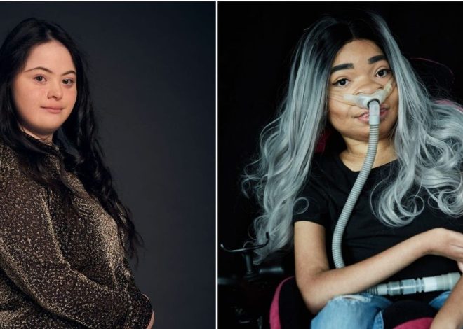 Zebedee Modelling Agency: Redefining Beauty and Championing Inclus…
