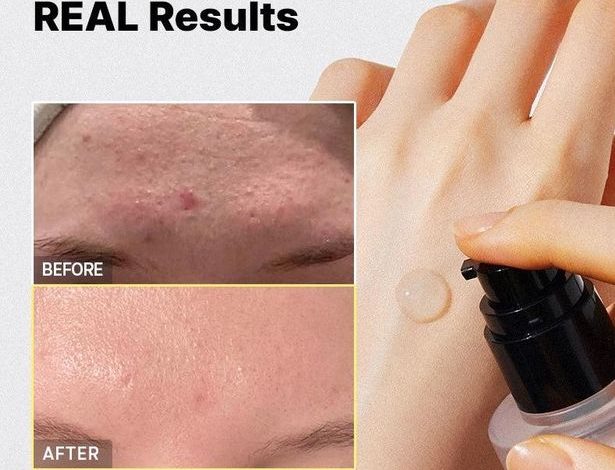 Viral Korean snail mucin essence that delivers ‘glass skin’ is on half price