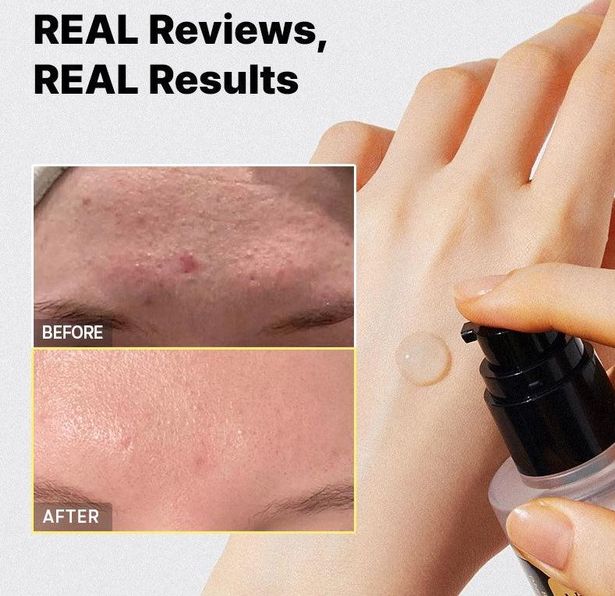 Viral Korean snail mucin essence that delivers ‘glass skin’ is on half price