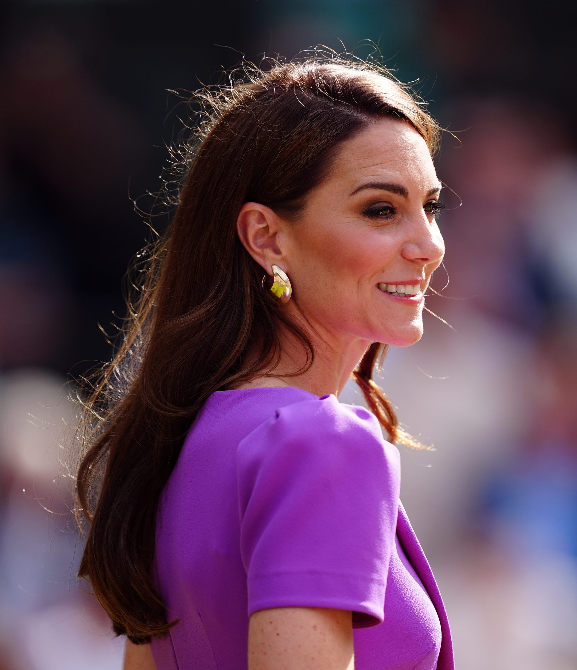 Kate Middleton’s ‘no needle botox’ serum has 40% off this Amazon Prime Day